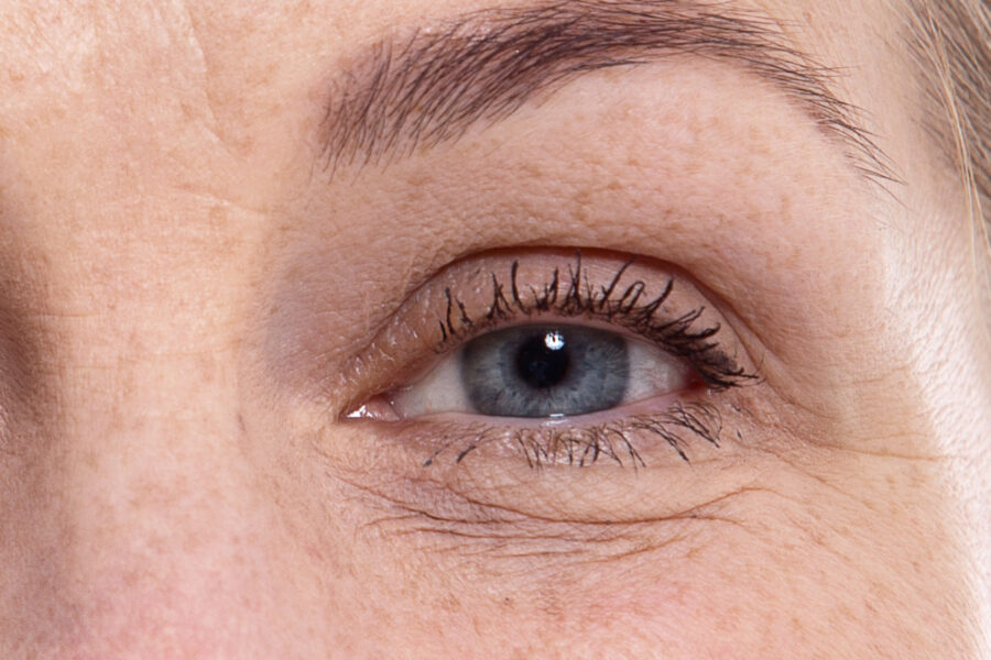 Nahaufnahme Traenenfalten